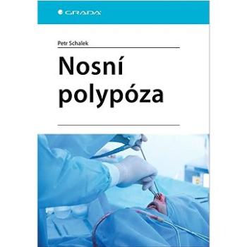 Nosní polypóza (978-80-271-3045-0)