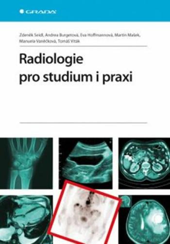 Radiologie pro studium i praxi - Zdeněk Seidl, Manuela Vaněčková, Andrea Burgetová, Eva Hoffmannová, Martin Mašek, Tomáš Viták