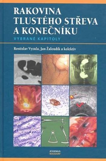 Rakovina tlustého střeva a konečníku - vybrané kapitoly Vyzula Rostislav, Žaloudík Jan a kolektiv - Vyzula Rostislav