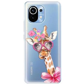 iSaprio Lady Giraffe pro Xiaomi Mi 11 (ladgir-TPU3-Mi11)
