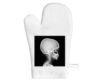 Chňapka X-Ray