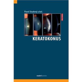 Keratokonus (978-80-7345-665-8)