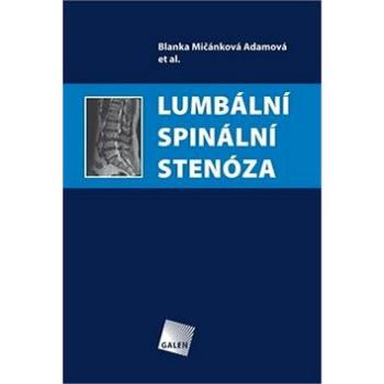Lumbální spinální stenóza (978-80-7262-945-9)