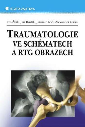 Traumatologie ve schématech a RTG obrazech - Ivo Žvák, Ferko Alexander, Jan Brožík, Jaromír Kočí - e-kniha