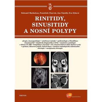 Rinitidy, sinusitidy a nosní polypy (978-80-738-7260-1)