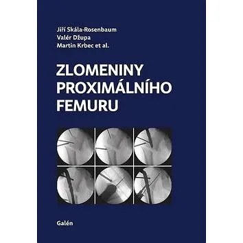 Zlomeniny proximálního femuru (978-80-7492-423-1)
