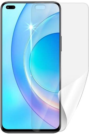 Védőfólia Screenshield HONOR 50 lite kijelzőre