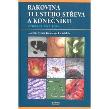 Rakovina tlustého střeva a konečníku (80-7345-140-9)