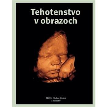 Tehotenstvo v obrazoch (978-80-8142-708-4)