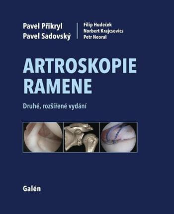 Artroskopie ramene - Pavel Přikryl, Sadovský Pavel, Hudeček Filip, Norbert Krajcsovics, Neoral Petr