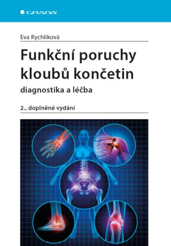 Funkční poruchy kloubů končetin - Eva Rychlíková - e-kniha