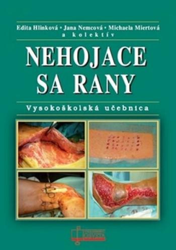 Nehojace sa rany - Edita Hlinková, Jana Nemcová, Michaela Miertová