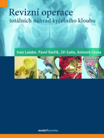 Revizní operace totálních náhrad kyčelního kloubu (Defekt) - Pavel Vavřík, Antonín Sosna, Ivan Landor, Jiří Gallo