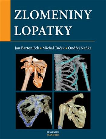 Zlomeniny lopatky - Jan Bartoníček, Ondřej Naňka, Michal  Tuček