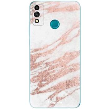 iSaprio RoseGold 10 pro Honor 9X Lite (rg10-TPU3_Hon9XL)