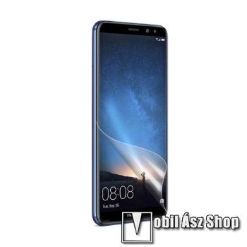 Képernyővédő fólia - Clear - 1db, törlőkendővel - HUAWEI Mate 10 Lite / HUAWEI nova 2i / HUAWEI Honor 9i / HUAWEI Maimang 6