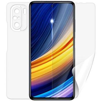 Screenshield POCO F3 na celé tělo (XIA-POCOF3-B)