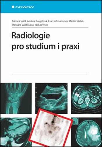 Radiologie pro studium i praxi - Zdeněk Seidl, Manuela Vaněčková, Andrea Burgetová, Eva Hoffmannová, Martin Mašek, Tomáš Viták