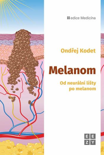 Melanom - Ondřej Kodet