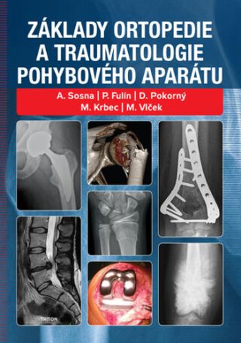 Základy ortopedie a traumatologie pohybového aparátu - Antonín Sosna, David Pokorný, Martin Krbec, P. Fulín