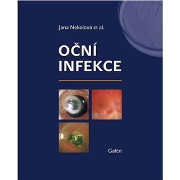 Oční infekce (978-80-7492-514-6)