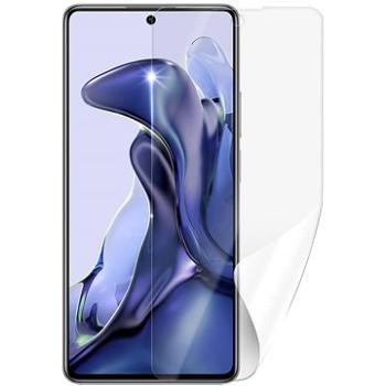 Screenshield Anti-Bacteria XIAOMI 11T na displej (XIA-11TAB-D)