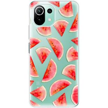 iSaprio Melon Pattern 02 pro Xiaomi Mi 11 Lite (mel02-TPU3-Mi11L5G)