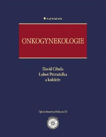 Onkogynekologie - David Cibula, Luboš Petruželka - e-kniha