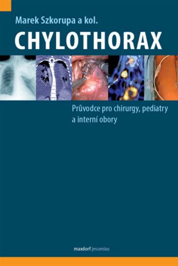 Chylothorax - Průvodce pro chirurgy, pediatry a interní obory - Szkorupa Marek