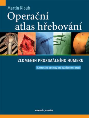 Operační atlas hřebování zlomenin proximálního humeru - Martin Kloub