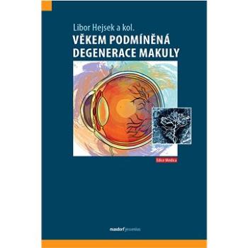 Věkem podmíněná degenerace makuly (978-80-7345-734-1)