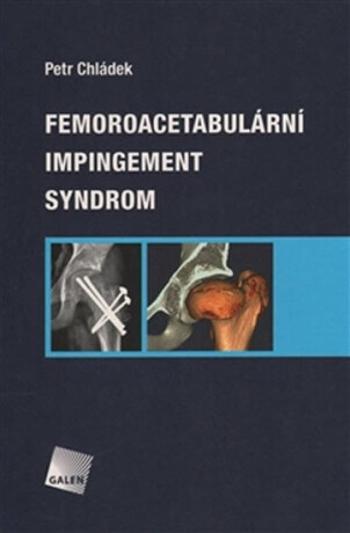 Femoroacetabulární impingement syndrom - Petr Chládek