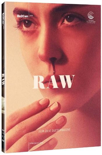 Raw (DVD)