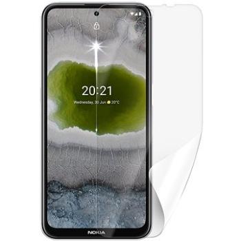 Screenshield NOKIA X10 5G na displej (NOK-X105G-D)