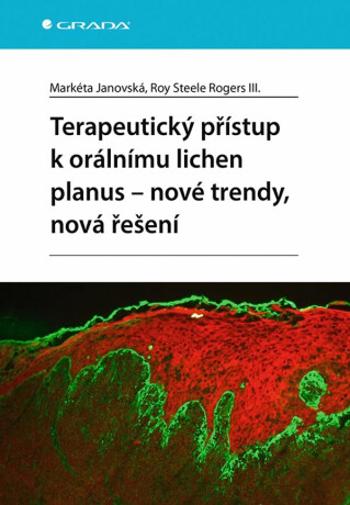 Terapeutický přístup k orálnímu lichen planus - nové trendy, nová řešení - Markéta Janovská, Roy Steele Rogers III.