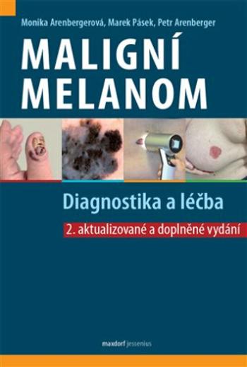 Maligní melanom - Diagnostika a léčba - Petr Arenberger, Monika Arenbergerová, Marek Pásek