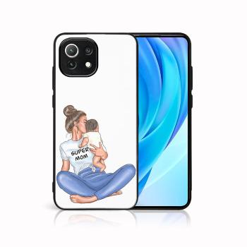 MY ART Ochranný kryt Xiaomi Mi 11 Lite / 11 Lite 5G / 11 Lite NE 5G-SUPERMOM (112)