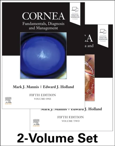 Cornea, 2-Volume Set - Edward J.  Holland, Mark J.  Mannis