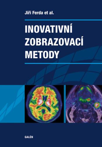 Inovativní zobrazovací metody - Jiří Ferda - e-kniha