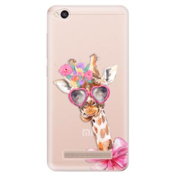 Odolné silikonové pouzdro iSaprio - Lady Giraffe - Xiaomi Redmi 4A