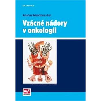 Vzácné nádory v onkologii (978-80-204-3658-0)