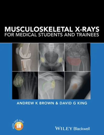Musculoskeletal X-Rays for Medical Students and Trainees - Andrew K.  Brown, David G.  King