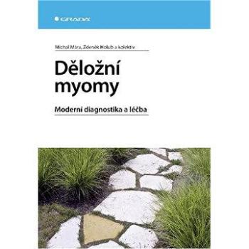 Děložní myomy (978-80-247-1854-5)