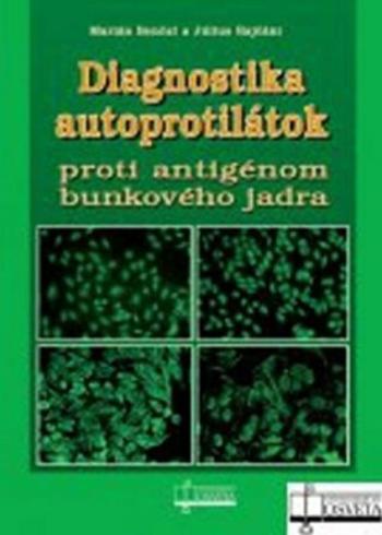 Diagnostika autoprotilátok proti antigénom bunkového jadra - Marián Benčat, Július Rajčáni