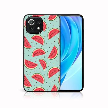 MY ART Ochranný kryt Xiaomi Mi 11 Lite / 11 Lite 5G / 11 Lite NE 5G -WATERMELON (120)