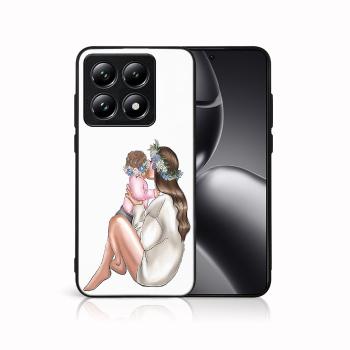 MY ART Ochranný kryt pre Xiaomi 14T Pro BABY GIRL (111)