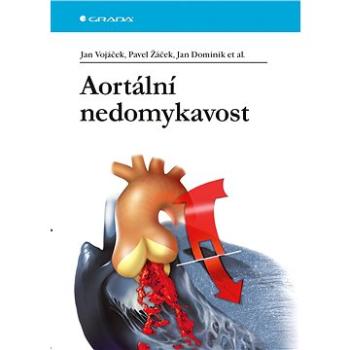 Aortální nedomykavost (978-80-247-5685-1)