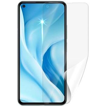 Screenshield Anti-Bacteria XIAOMI 11 Lite 5G NE na displej (XIA-11LT5GNEAB-D)