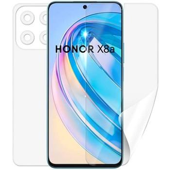 Screenshield HONOR X8a fólie na celé tělo (HUA-HONX8A-B)