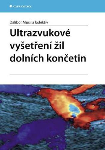 Ultrazvukové vyšetření žil dolních končetin - Dalibor Musil - e-kniha